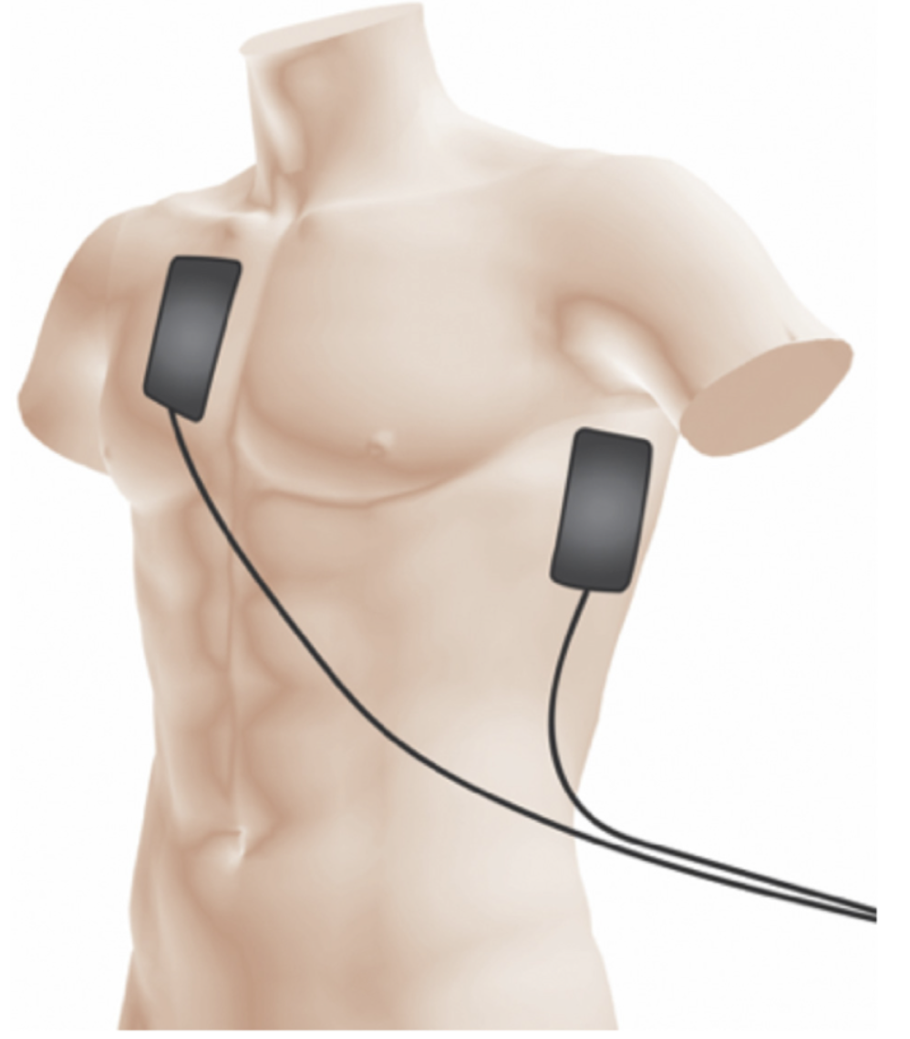 Electron density as function of spatial dimensions x and y.